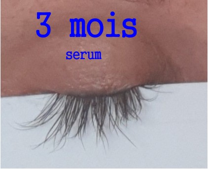 photo résultat 3 mois serum MD-lashes